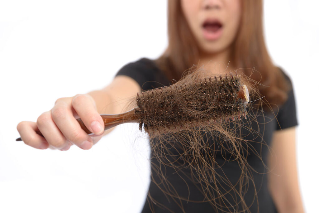 queda de cabelo, alopecia